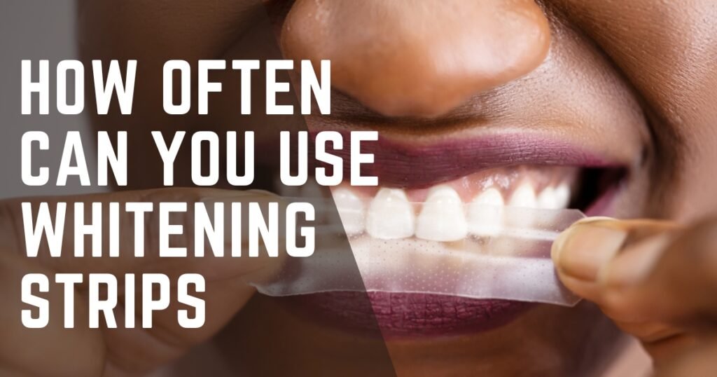 How Often Can You Use Whitening Strips