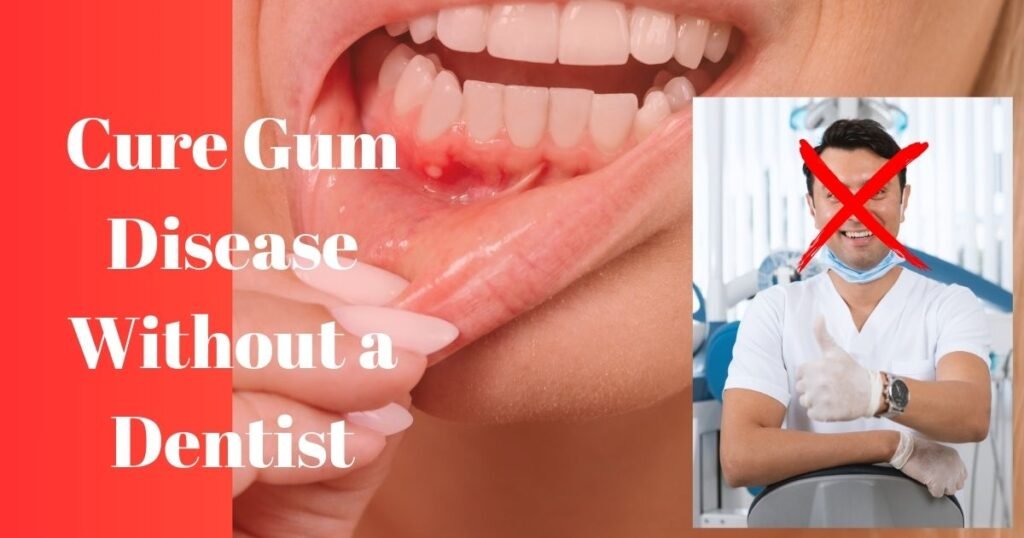How to Cure Gum Disease Without a Dentist