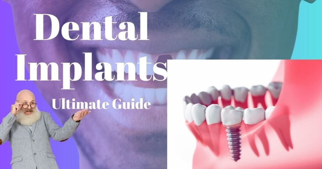 Dental Implants