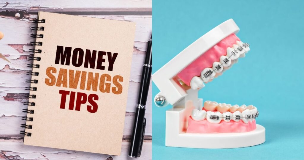 How Much Do Braces Cost in 2025? A Complete Price Breakdown 12 How Much Do Braces Cost