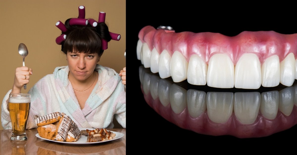 Full Mouth Dental Implants Cost in 2025: What You’ll Really Pay & How to Save Big 16 Is it hard to eat with full dental implants