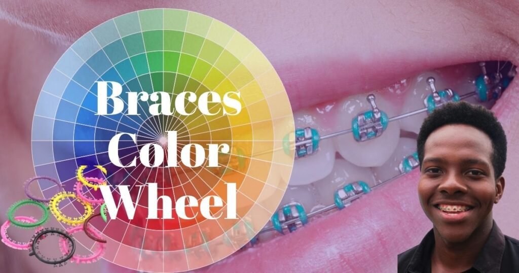 Braces Color Wheel