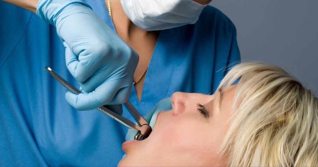 tooth extraction 1 tooth extraction