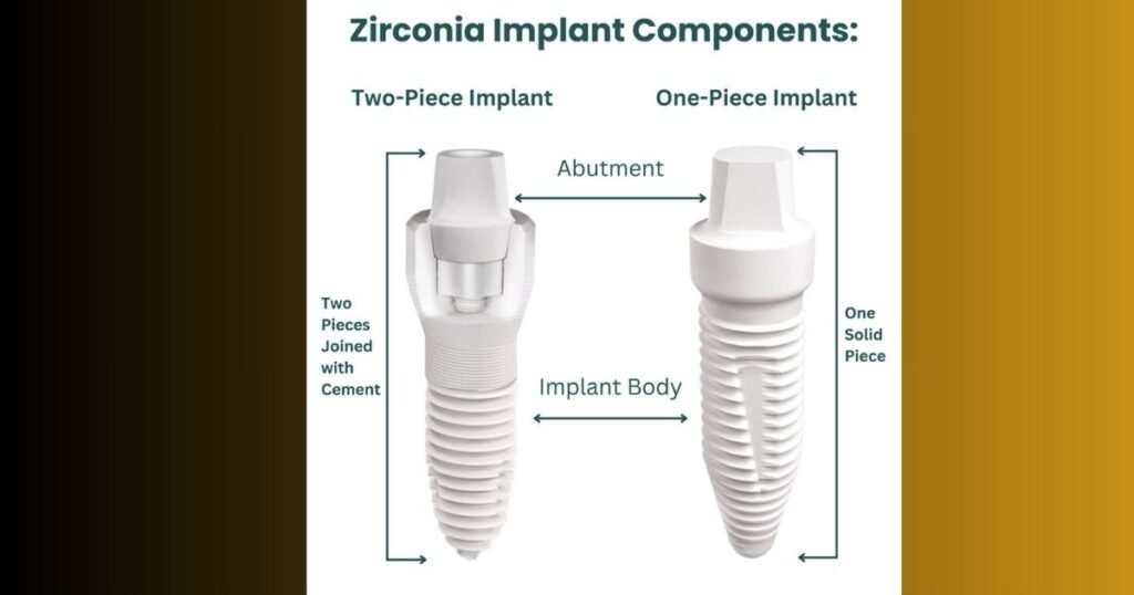 Endosteal Implants in 2025:Cost, Benefits & Step-by-Step Procedure Guide 3 Endosteal Implants