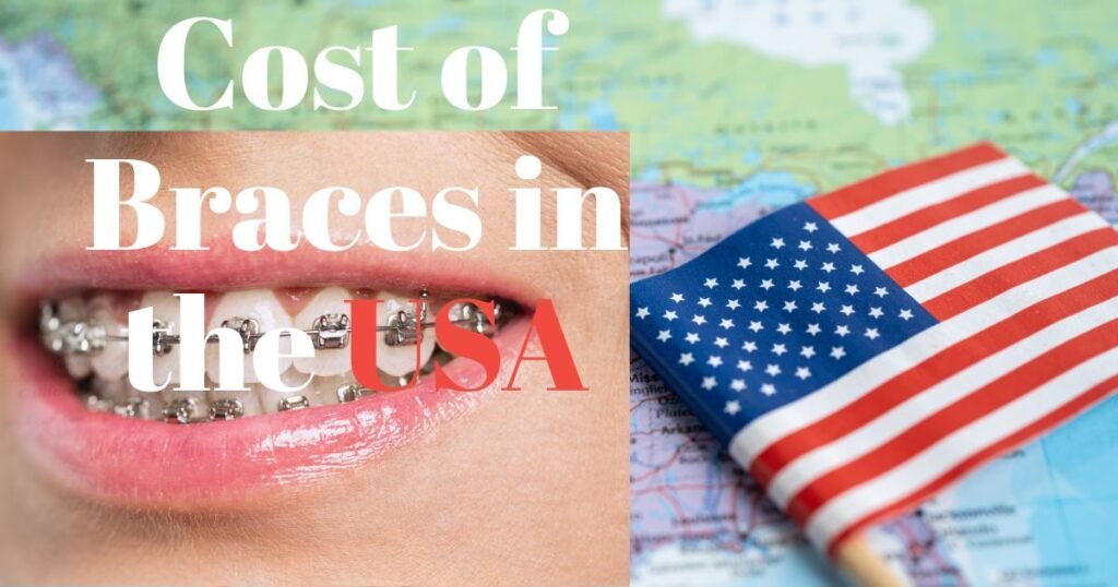 How Much Do Braces Cost in 2025? A Complete Price Breakdown 3 How Much Do Braces Cost