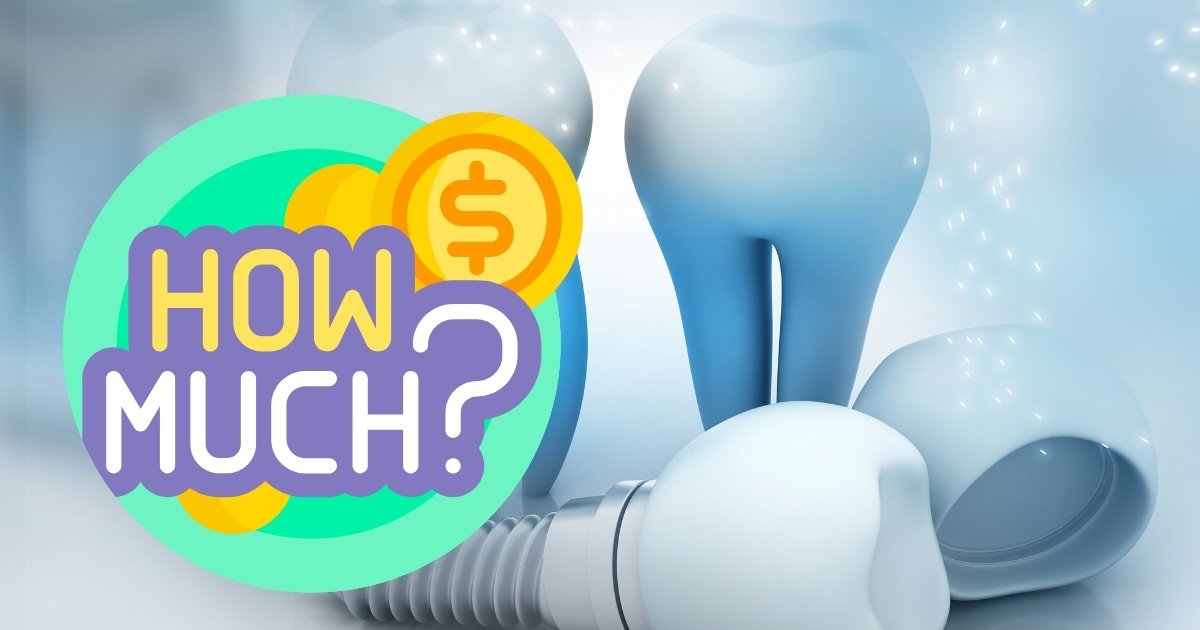 Full Mouth Dental Implants Cost in 2025: What You’ll Really Pay & How to Save Big 24 How much does it cost to get all your teeth pulled and get implants