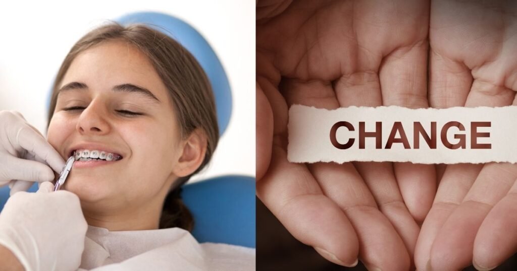 Braces Color Wheel: How to Pick the Perfect Shade for Your Smile! 10 Braces Color Wheel