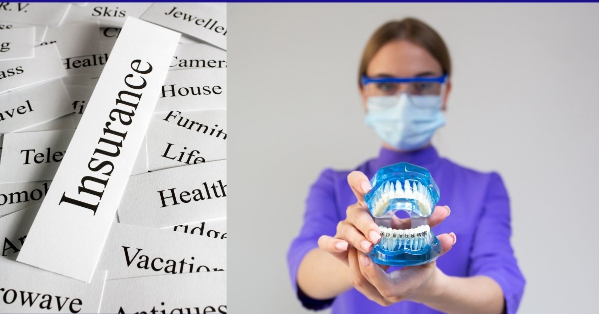 Full Mouth Dental Implants Cost in 2025: What You’ll Really Pay & How to Save Big 27 Does insurance cover full mouth dental implants
