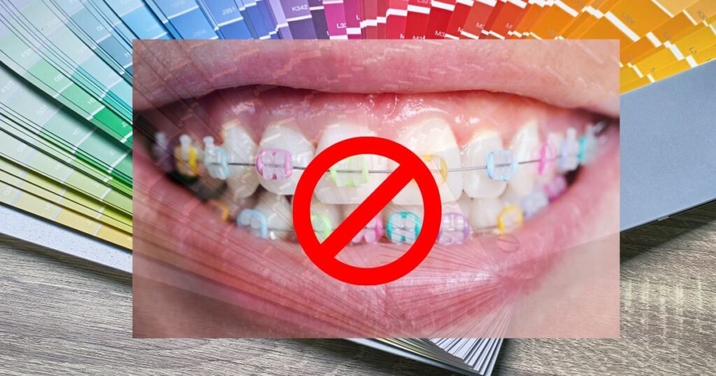 Braces Color Wheel: How to Pick the Perfect Shade for Your Smile! 13 Braces Color Wheel