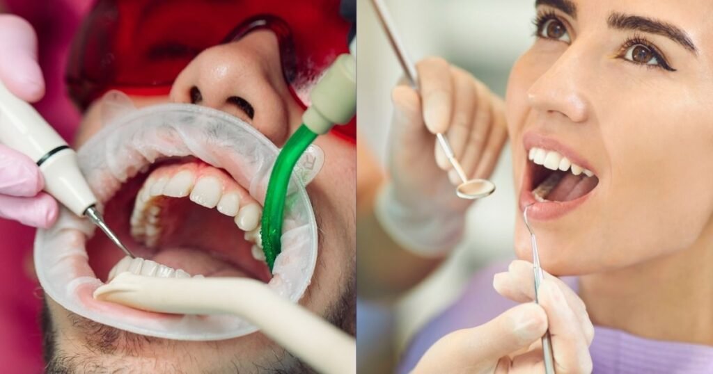 How Long Does It Take to Get Braces On? Step-by-Step Breakdown 4 How Long Does It Take to Get Braces On