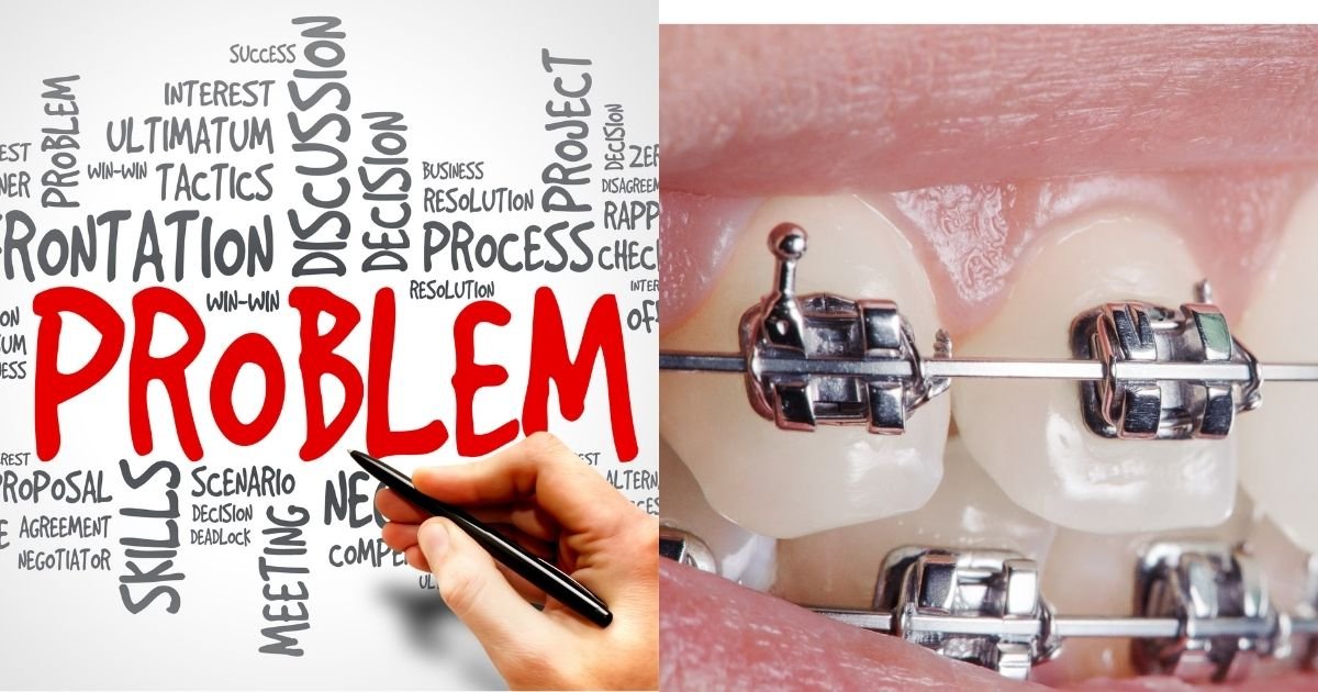 Invisalign vs Braces? The Ultimate Guide to Choosing the Right Option in 2025! 32 What problems can Invisalign cause
