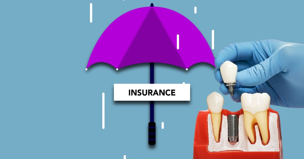 Full Mouth Dental Implants Cost in 2025: What You’ll Really Pay & How to Save Big 38 Will insurance cover dental implants
