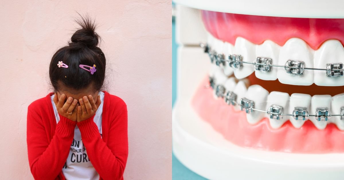 Invisalign vs Braces? The Ultimate Guide to Choosing the Right Option in 2025! 37 Why do braces hurt more than Invisalign