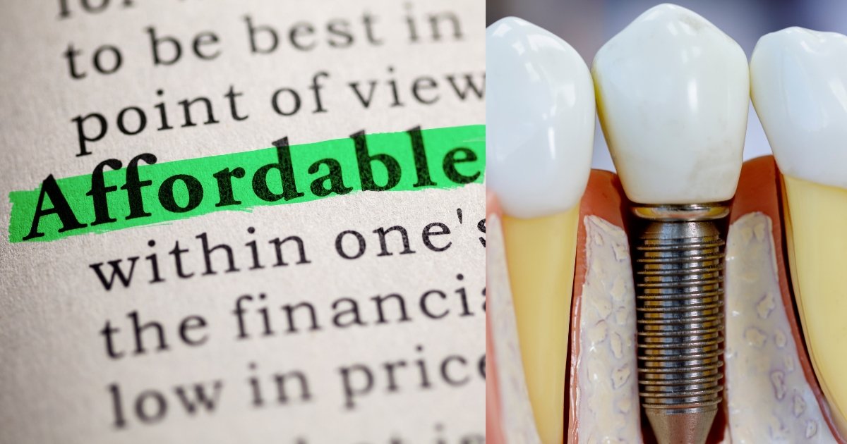 Full Mouth Dental Implants Cost in 2025: What You’ll Really Pay & How to Save Big 39 How can I afford implants