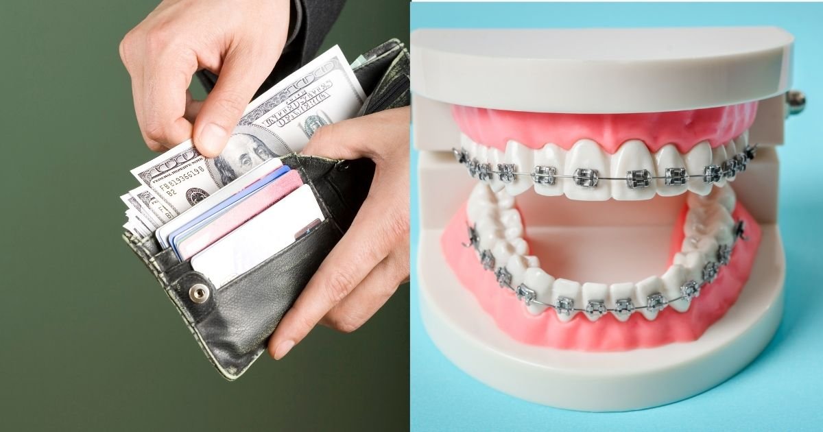 Invisalign vs Braces? The Ultimate Guide to Choosing the Right Option in 2025! 39 Why is Invisalign so expensive