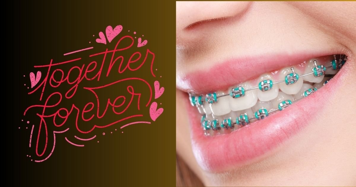 Invisalign vs Braces? The Ultimate Guide to Choosing the Right Option in 2025! 40 Do you have to wear Invisalign forever
