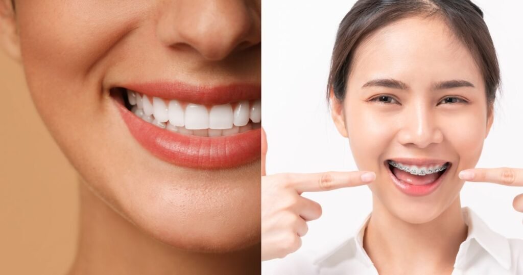 Braces Colors Guide 2025 : How to Choose the Best Shade for Your Smile 5 Braces Colors