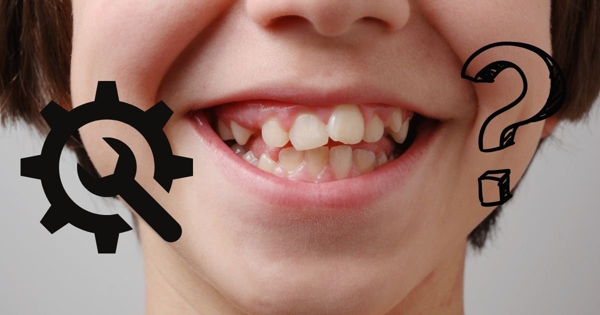 Invisalign vs Braces? The Ultimate Guide to Choosing the Right Option in 2025! 43 Can Invisalign fix crooked teeth