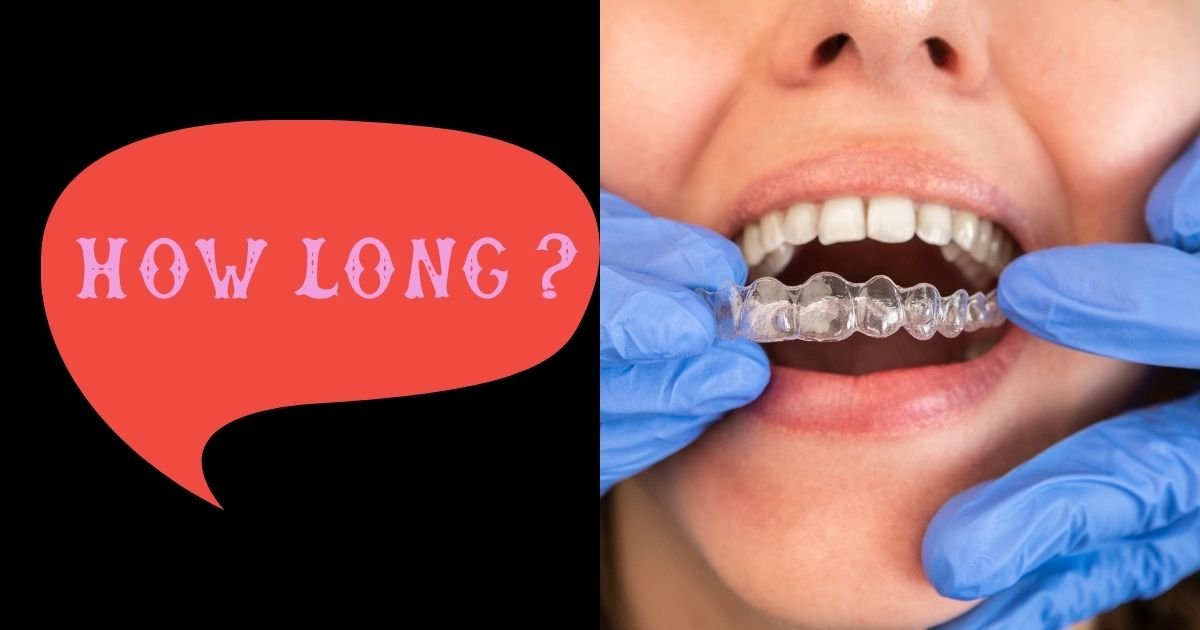 Invisalign vs Braces? The Ultimate Guide to Choosing the Right Option in 2025! 45 How long do you wear Invisalign