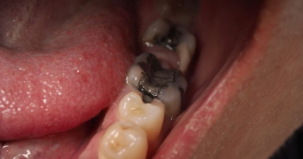 Vaping Ruined My Teeth! Shocking Truth About Its Hidden Dental Dangers 6 Vaping Ruined My Teeth