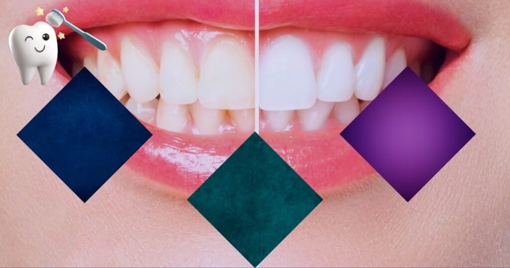 Best Braces Colors for Girls in 2025: Cute, Trendy & Stylish Choices 7 Best Braces Colors for Girls