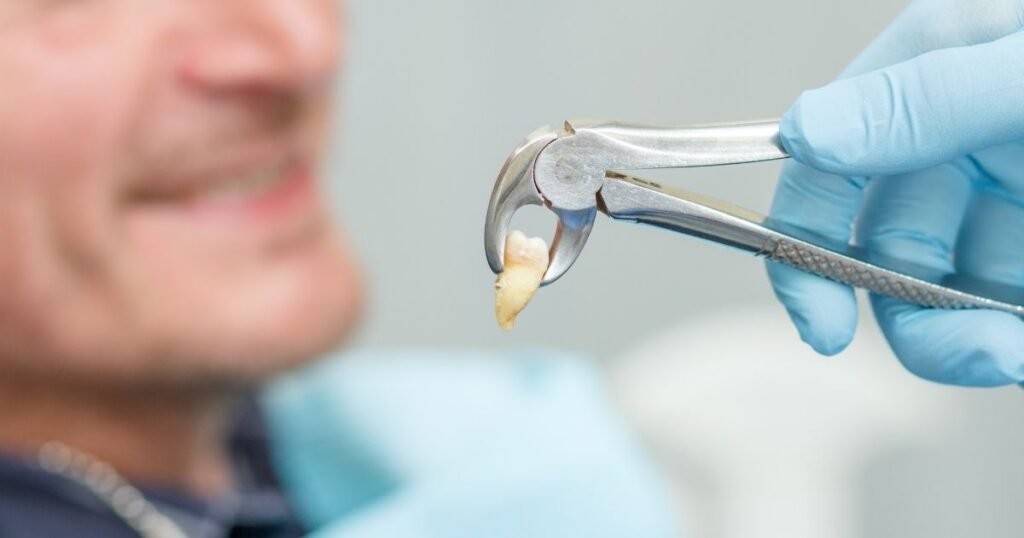 Instant Relief: How to kill tooth pain nerve in 3 seconds permanently 6 kill tooth pain nerve in 3 seconds permanently