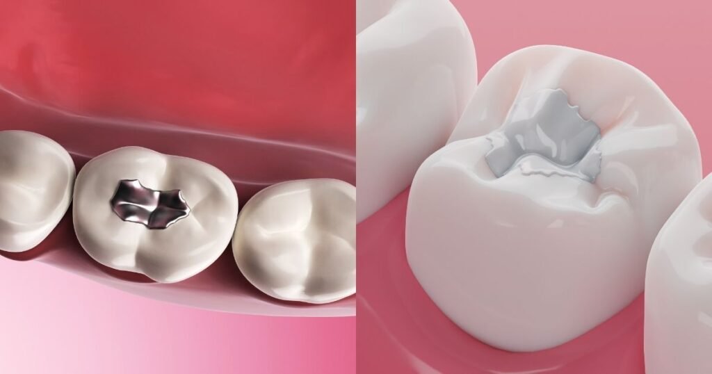 Instant Relief: How to kill tooth pain nerve in 3 seconds permanently 7 kill tooth pain nerve in 3 seconds permanently