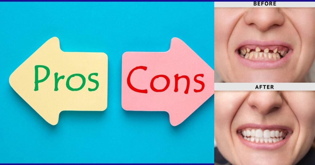 Full Mouth Dental Implants Cost in 2025: What You’ll Really Pay & How to Save Big 10 Full Mouth Dental Implants Cost