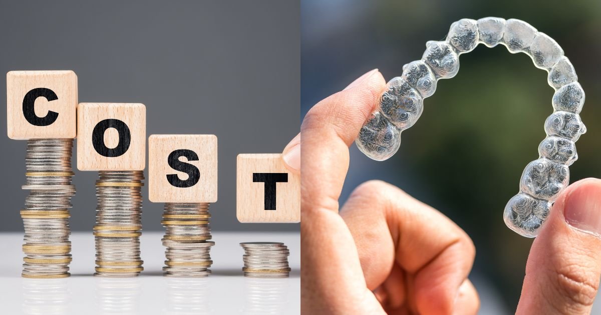 Invisalign vs Braces? The Ultimate Guide to Choosing the Right Option in 2025! 10 How much does Invisalign cost?