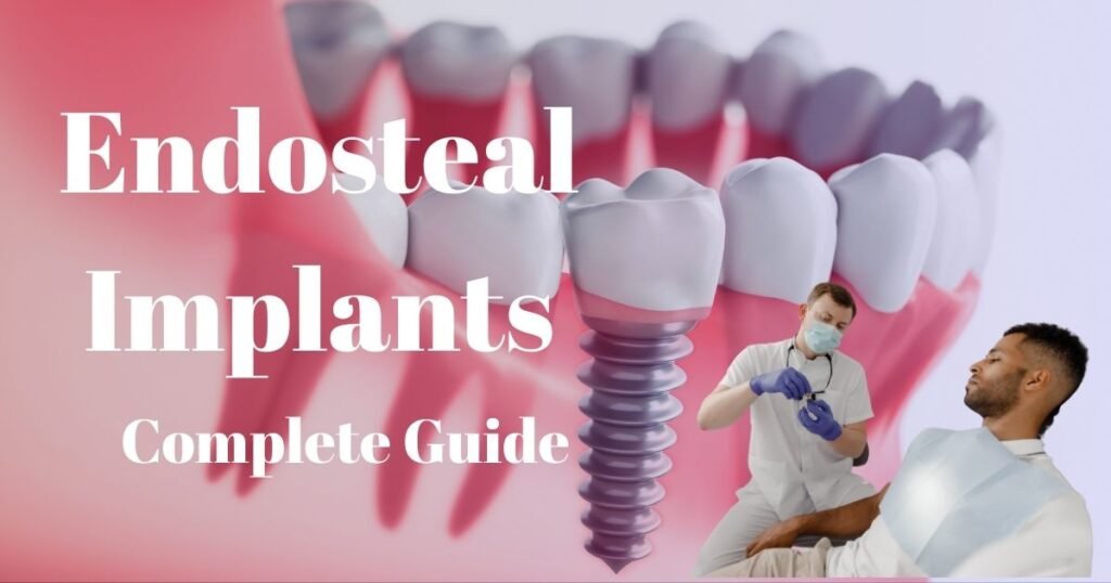 Dental Implants