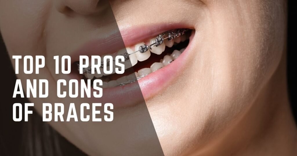 Pros and Cons of Braces