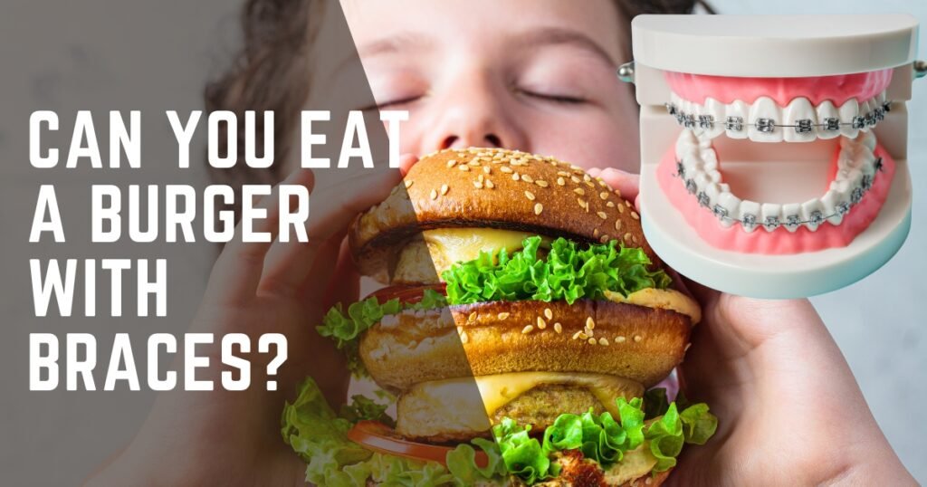 Home 3 Can You Eat a Burger with Braces