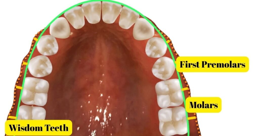 7 most Important Things to Know About Pulling Teeth for Braces 3 Pulling Teeth for Braces
