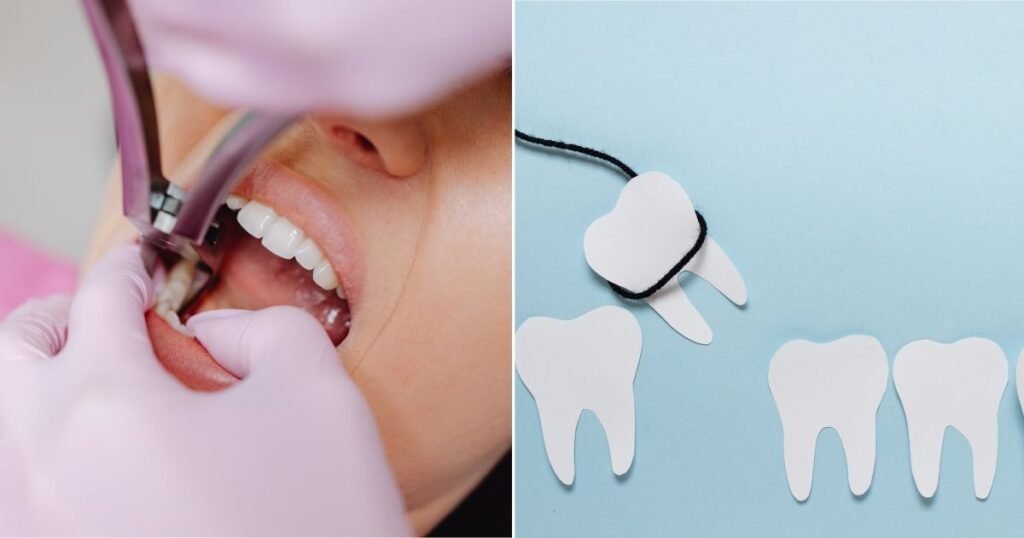 7 most Important Things to Know About Pulling Teeth for Braces 4 Pulling Teeth for Braces