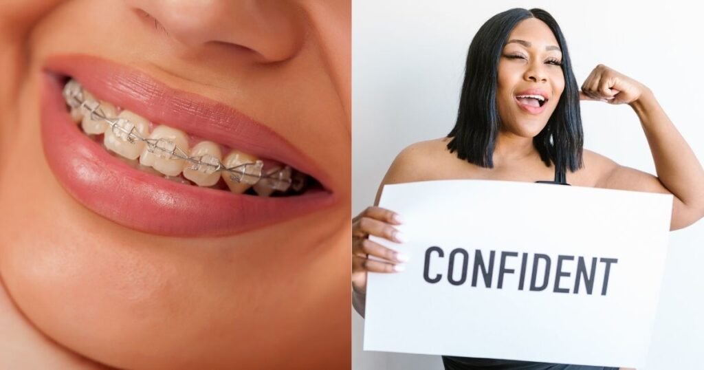 Top 10 Pros and Cons of Braces You Should Know 3 Pros and Cons of Braces