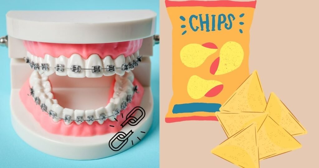 Can You Eat Tortilla Chips with Braces? 10 Orthodontist-Backed Warnings 3 Can You Eat Tortilla Chips with Braces