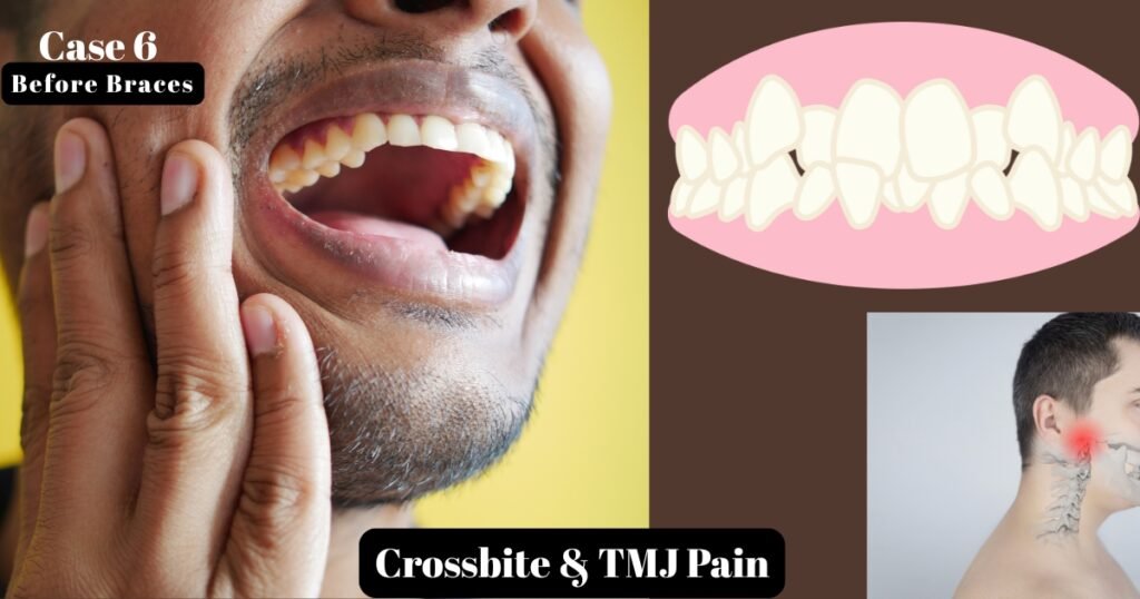 Before and After Braces: A Complete Transformation Guide 19 Before and After Braces