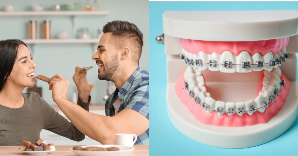 Can You Eat Chocolate with Braces? A Complete Guide 3 Can You Eat Chocolate with Braces
