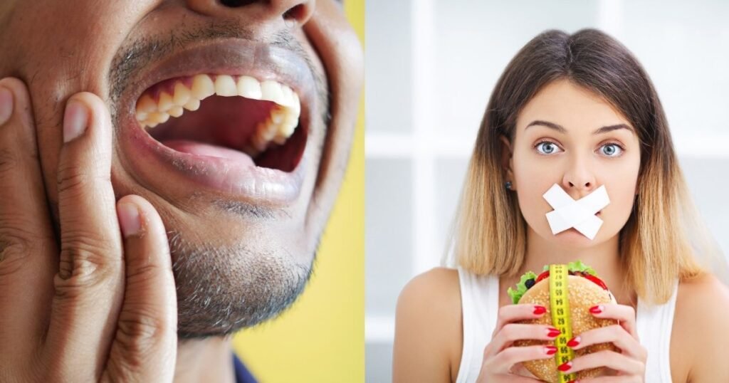 Top 10 Pros and Cons of Braces You Should Know 4 Pros and Cons of Braces