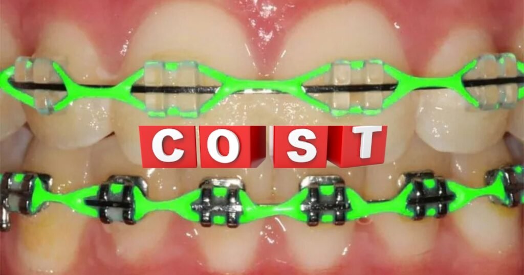 Green Braces: Are They Right for You? Pros, Cons, and Most valuable Tips! 8 Green Braces