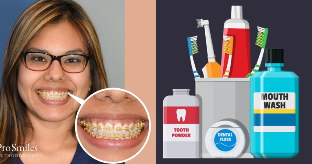 Gold Braces: The Ultimate Guide to Style, Cost, and Benefits 9 Gold Braces
