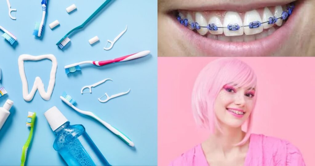 Lavender Braces: The Trendy Way to Add Style to Your Smile! 5 Lavender Braces