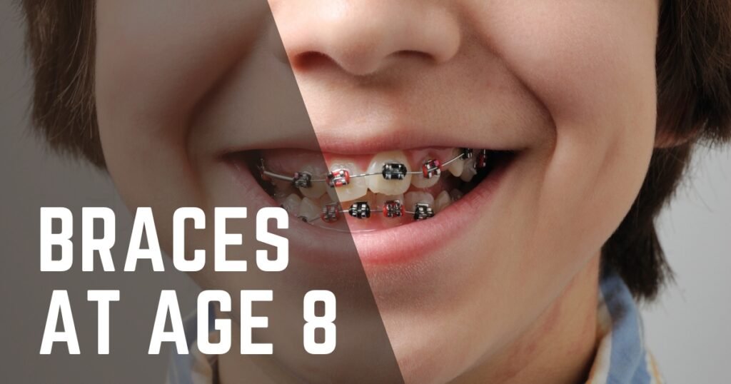 Braces at Age 8