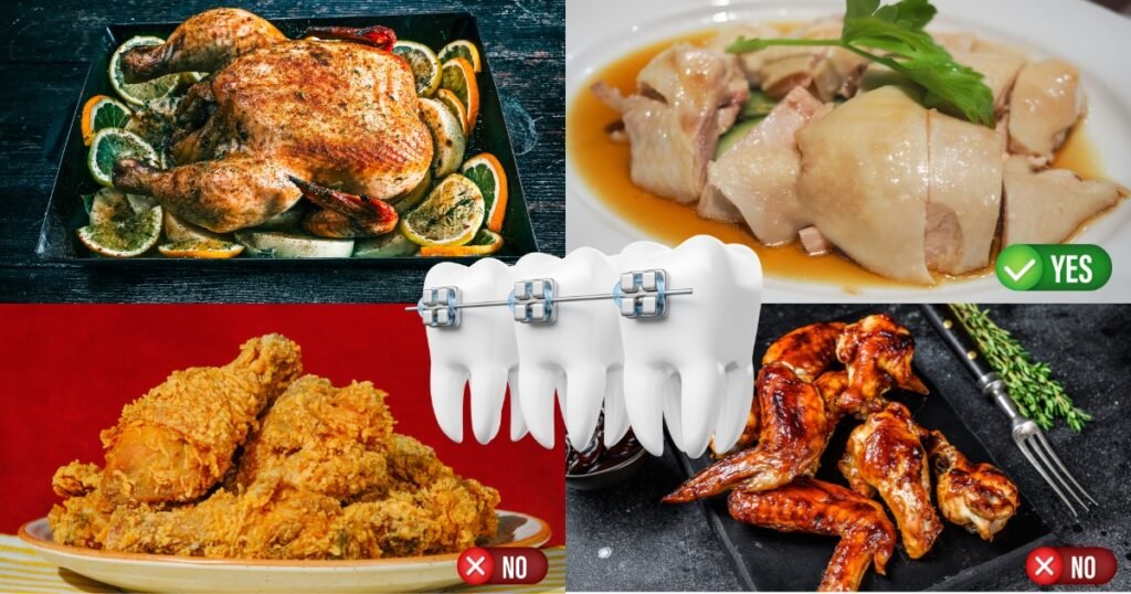 Can You Eat Chicken with Braces? 4 Can You Eat Chicken with Braces?
