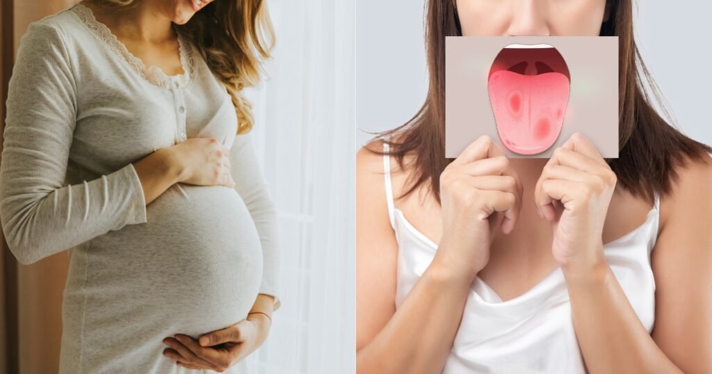 Can You Get Braces While Pregnant? 101 best Guide for Expecting Moms 3 Can You Get Braces While Pregnant