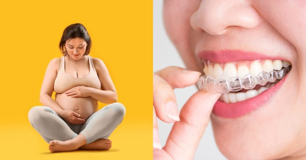Can You Get Braces While Pregnant? 101 best Guide for Expecting Moms 4 Can You Get Braces While Pregnant