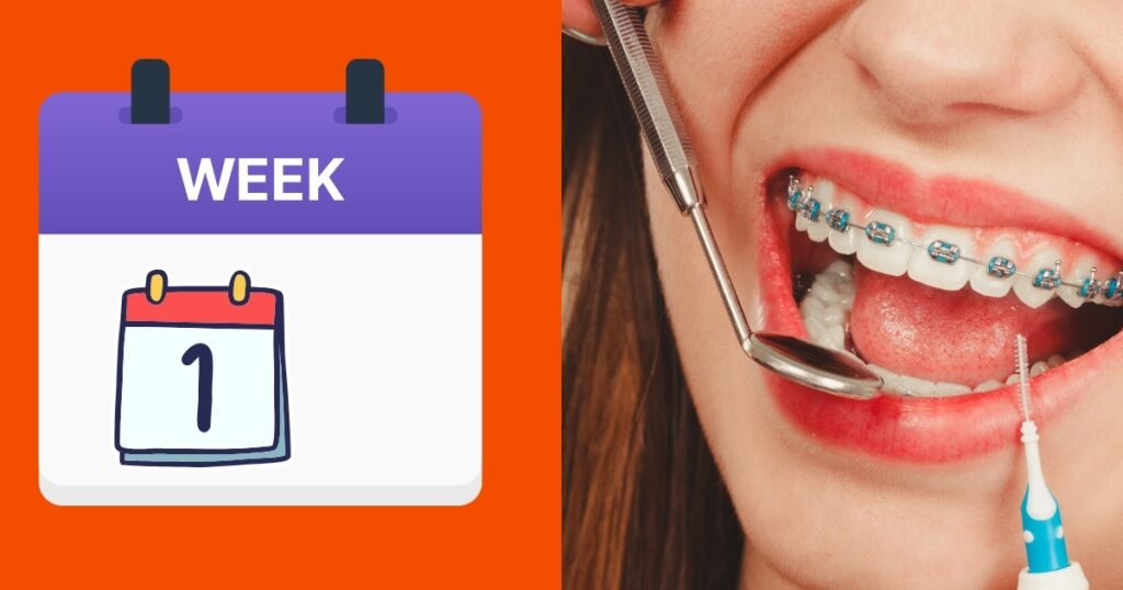 What to Eat with Braces the First Week? 20 Easy & Delicious Ideas! 3 What to Eat with Braces the First Week