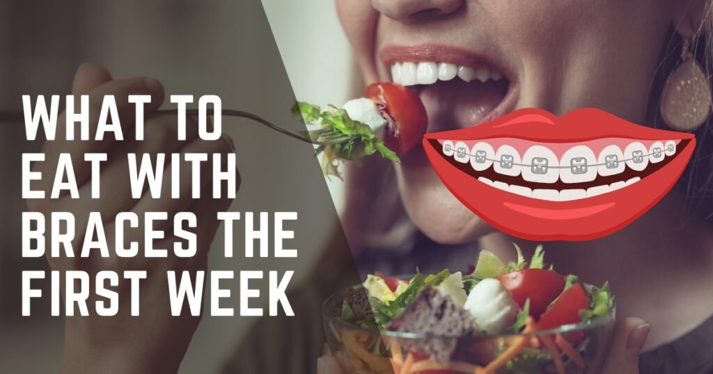 What to Eat with Braces the First Week