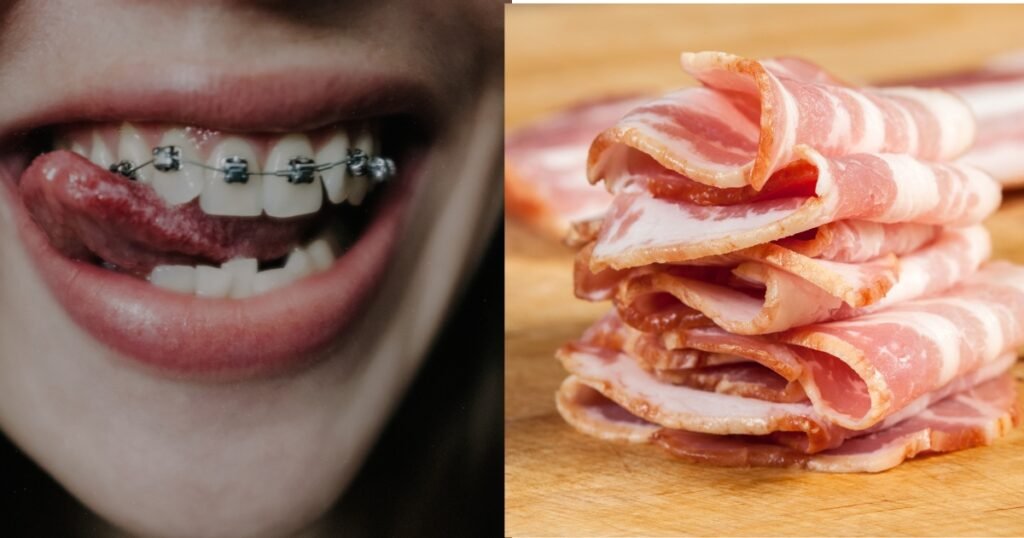 Can You Eat Bacon With Braces? 5 Facts You Should Know 4 Can You Eat Bacon With Braces
