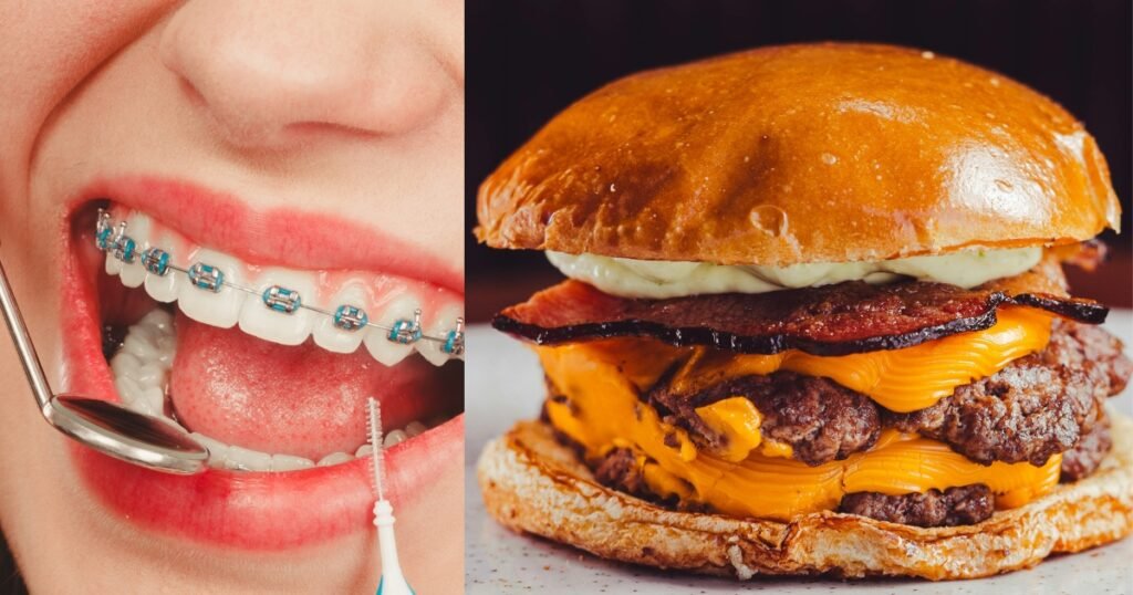 Can You Eat Bacon With Braces? 5 Facts You Should Know 6 Can You Eat Bacon With Braces
